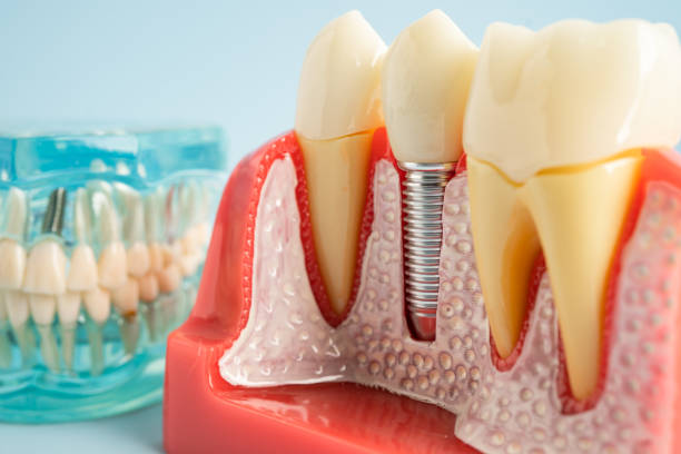 Best Periodontal (Gum) Disease Treatment  in Macon, MO